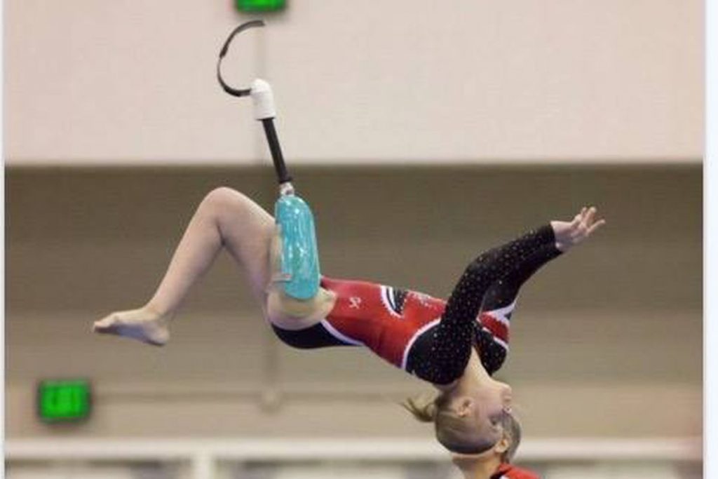 Image of The gymnast didn’t let losing a leg stop her from competing